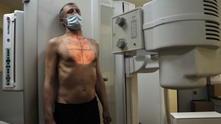 Респираторы и уборки: как работают в колонии для туберкулезных больных в Чепецке